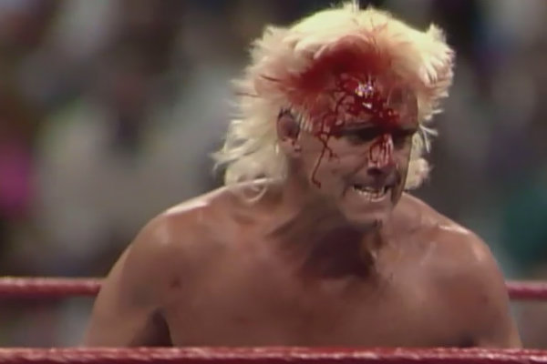 10 WrestleMania Blood Baths You Need To See Page 3
