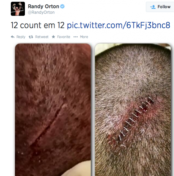 Randy Orton twitter