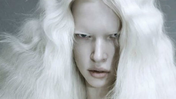 8 Top Models With Albinism
