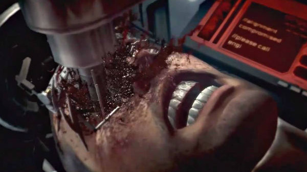 dead space 2 eye surgery