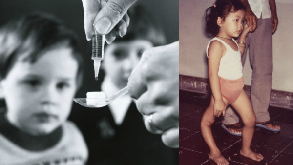 polio girl and treatment