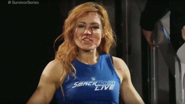Becky Lynch Busted Open