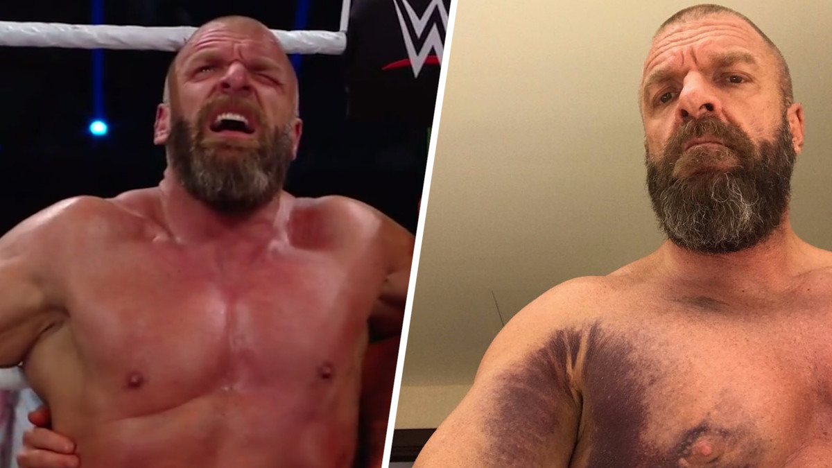 10 Horrifying Wrestling Injuries Captured On Camera Page 8