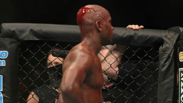 UFC Bloody Man