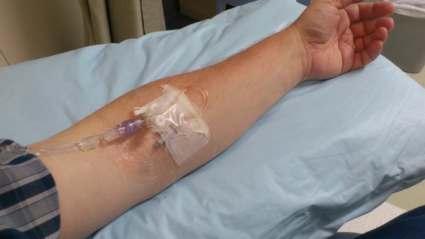 intravenous immunoglobulin