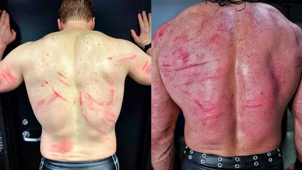 Sheamus Drew McIntyre Welts