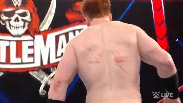 Sheamus Welts