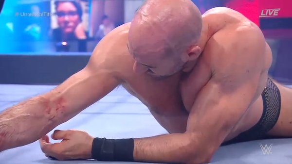 Cesaro Arm WWE WrestleMania Backlash