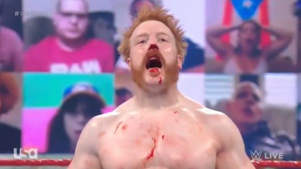 Sheamus Blood Broken Nose