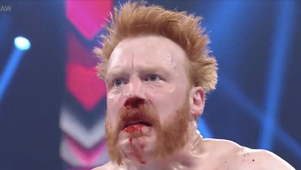 Sheamus Busted Open On WWE Raw, Suffers Broken Nose