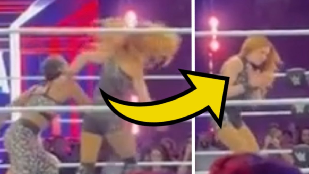 Top WWE star Becky Lynch has arm ripped open during brutal